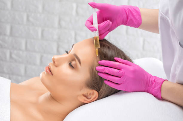PRP hair treatment in Dubai