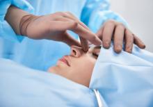 rhinoplasty