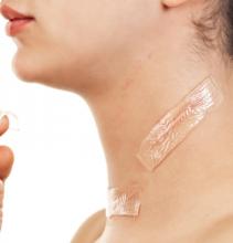 Laser Scar Removal in Dubai