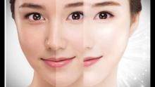 Skin Whitening in Dubai