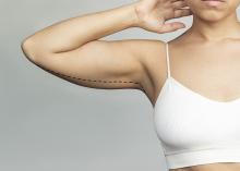 عملية شد الذراعين في الرياض