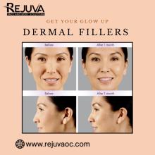 Dermal Fillers Newport Beach