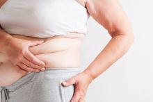 Post-weight loss surgery in Dubai