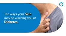  diabetes skin warning signs