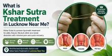 Kshar Sutra Treatment in Lucknow