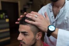 Hair Replacement Service
