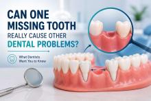 Tooth Loss