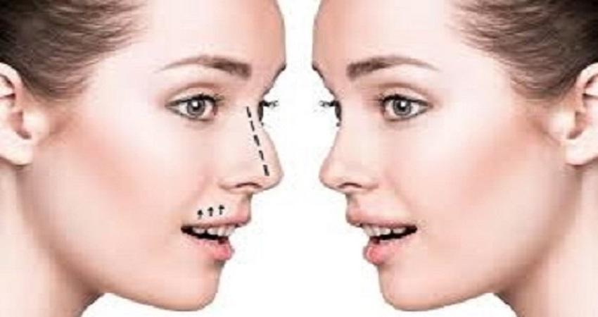 عملية تجميل الأنف في الرياض