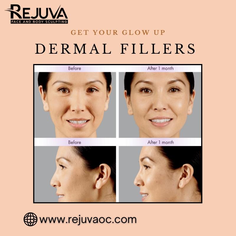 DermalFillers, YouthfulGlow, WrinkleFreeSkin, NaturalBeautyBoost, FacialRejuvenation, AntiAgingSolutions, SmoothRadiantSkin,