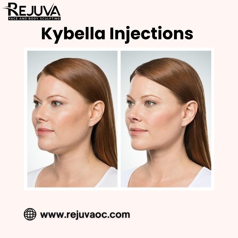 KybellaInjections, NewportBeachKybella, SkinTightening, Rejuvaoc, FacialRejuvenation, AntiAgingTreatment,