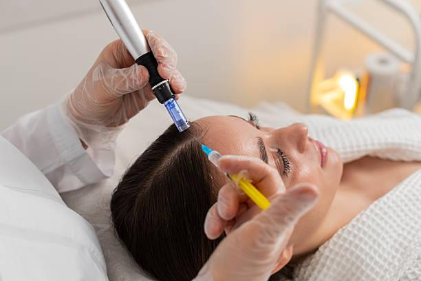 Exosomes Hair Therapy in Dubai