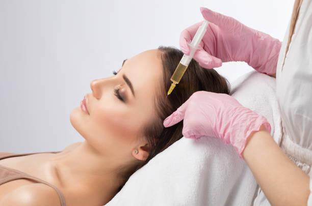 PRP hair treatment in Dubai