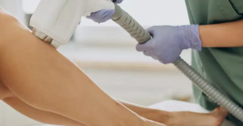 laser hair removal in Covina, CA