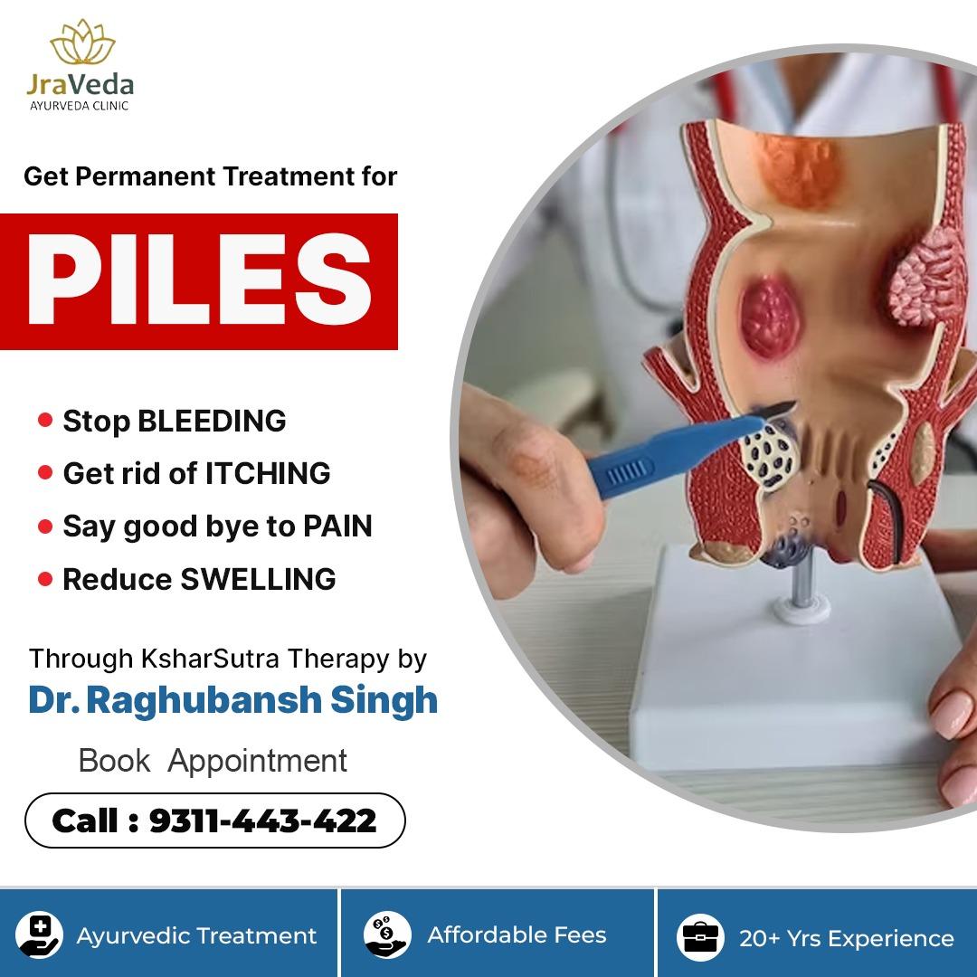 Best Piles doctor in Delhi NCR