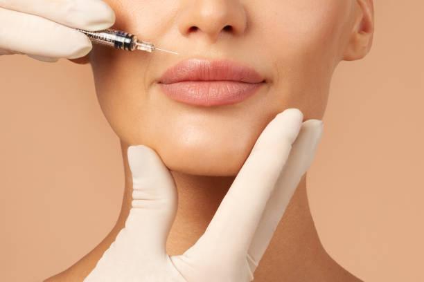 Lip fillers injection in Dubai