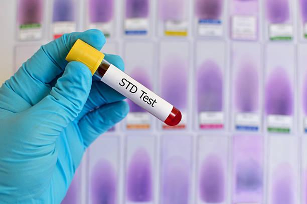 STD test in Dubai