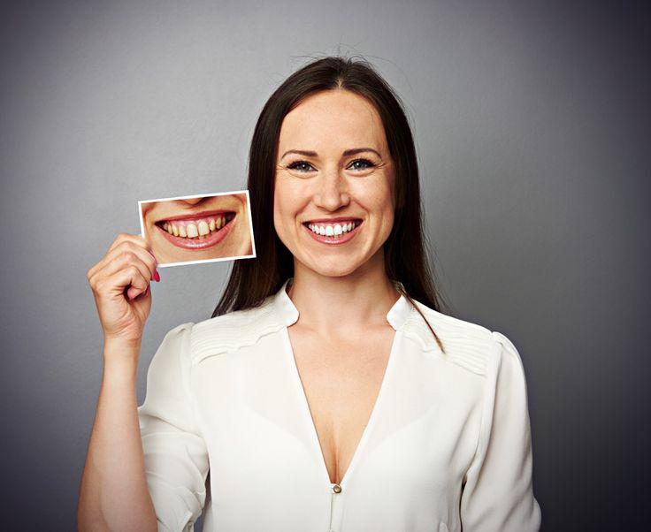 #DentalClinicInMississauga #BestDentalClinicInMississauga #EmergencyDentalClinicInMississauga #DentalClinicInMississaugaON #DentistInMississaugaOntario #BestDentistInMississauga #DentistInMississauga #FamilyDentistInMississauga #Top10DentistInMississauga #CosmeticDentistInMississauga