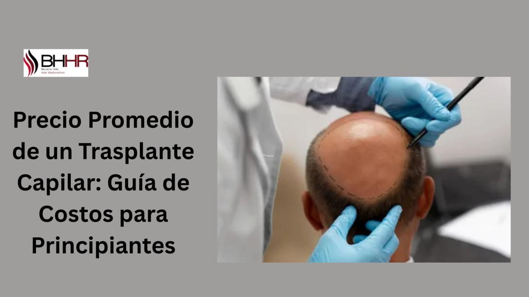  trasplante de pelo precio 