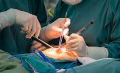 General surgery