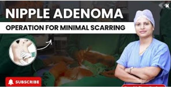 best breast cancer surgeon in pune