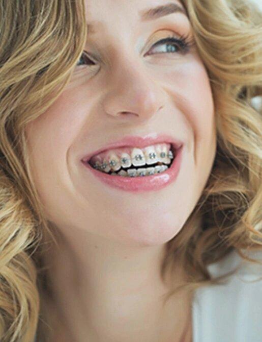 woman with dental Braces