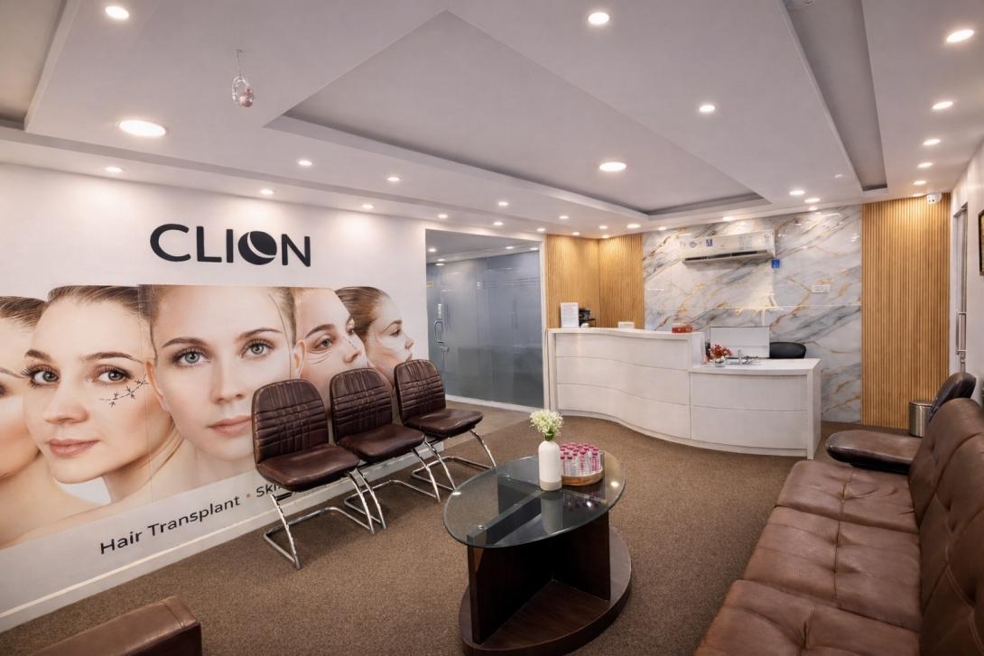 Best Hair Transplant Ahmedabad